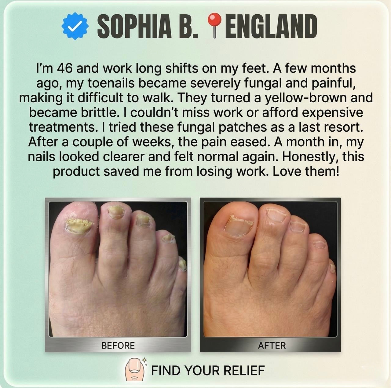 Toenail Fungus Nail Patches