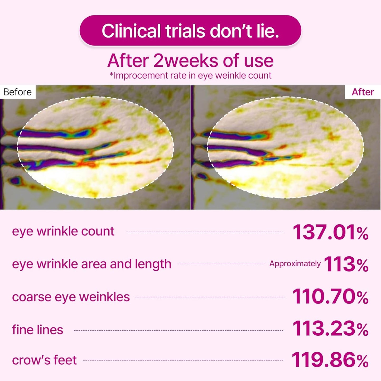 Anti Wrinkle Calcium Eye Patch